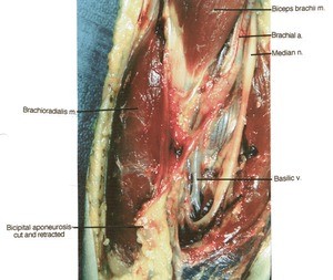 Natural color photograph of dissection of right cubital region, anterior view, showing the nerves and vasculature in the cubital fossa with the bicipital aponeurosis cut and reflected