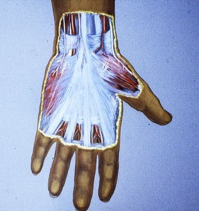 Illustration of dissected palmar surface of left hand, showing the palmar aponeurosis in relation to the radial & ulnar arteries and nerves & median n., & at the wrist, branches to the digits