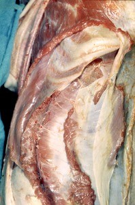 Natural color photograph of dissection of the abdominal wall, anterior view, showing layers of muscle