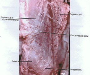 Natural color photograph of superficial dissection of the right antero-medial thigh