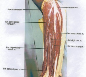 Natural color photograph of dissection of the left forearm, posterior view, showing extensor musculature