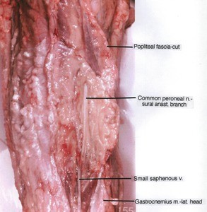 Natural color photograph of right knee, posterior view, showing nerve, vein and popliteal fascia