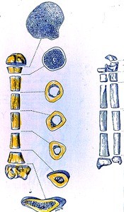 Illustration of cross sections of right humerus and anterior view of right humerus, radius and ulna