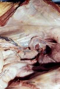 Natural color photograph of dissection of the pelvic cavity, anterior view, showing the pelvic viscera and mesentery