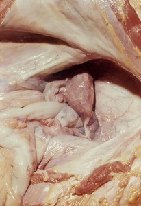 Natural color photograph of dissection of the pelvic cavity, anterior view, showing the pelvic viscera and mesentery