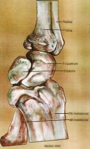 Illustration of the wrist, medial view, showing the radius, carpal bones, and metacarpal bones