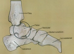 Illustration of bones of the left ankle and foot, medial view