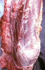 Natural color photograph of dissection of the left knee, anterior view, with the skin reflected to expose cutaneous nerves