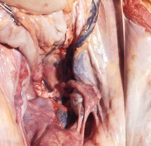 Natural color photograph of dissection of the pelvic cavity, anterior view, showing the uterus and its associated structures