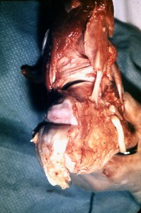 Natural color photograph of dissection of the right ankle, posterolateral view, emphasizing the posterior talar articular surface