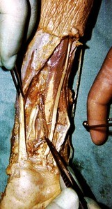 Natural color photograph of dissection of the wrist, emphasizing arterial structures