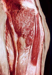 Natural color photograph of dissection of the right hip and upper leg, posterior view, with the skin removed to expose the underlying muscle