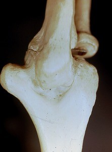 Bones of the elbow, posterior, including the humerus, the radius and the ulna