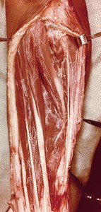 Natural color photograph of dissection of the left forearm, anterior view