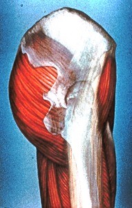 Illustration of right hip joint showing relation of gluteus maximus m. to ilium, ischium & femur (ghosted in)