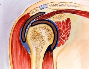 Illustration of diagrammatic sagittal section through the gleno-humeral joint and surrounding tissues, including overlying muscles, joint capsule and synovial fluid in the joint cavity