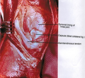 Natural color photograph of left knee, medial view, showing tendon, ligament and synovium with Sartorius muscle retracted