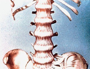 Illustration of skeleton of posterior abdominal wall and pelvis: lower ribs, lumbar vertebrae and intervertebral disks, sacrum and ilia, with ant. longitudinal ligament and left ant. sacroiliac lig