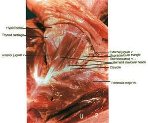 Natural color photograph of left side of neck, lateral view, showing muscles, veins, cartilage and bones