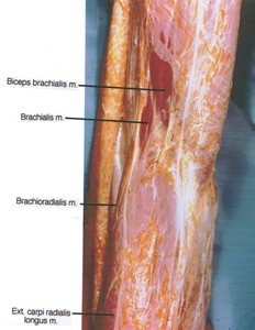 Natural color photograph of dissection of right cubital region, dorsal view, showing the superficial musculature and fascia