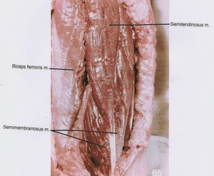 Natural color photograph of left thigh, posterior view, showing muscles