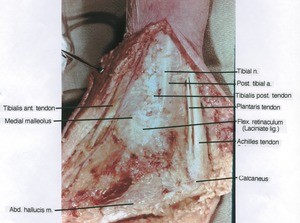 Natural color photograph of right ankle, medial view showing artery, bones, ligament, nerves, and tendons