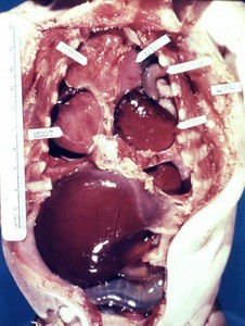 Natural color photograph of dissection of a fetus, coronal section of body cavity (posterior view), showing the major internal organs