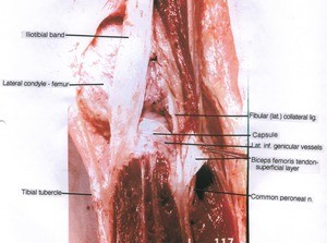 Natural color photograph of left knee, lateral view, showing muscle, vessels, cartilage, tendons, ligament and bone