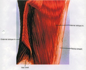 Illustration of right abdominal wall, including retracted external and internal abdominal oblique muscle and rectus sheath, lateral view