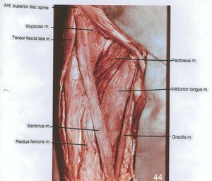 Natural color photograph of dissection of the femoral triangle, anterior view, showing the major musculature