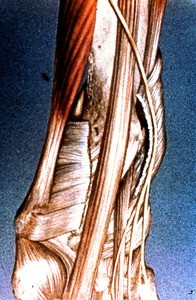 Illustration of wrist dissected to show tendons and retinacula