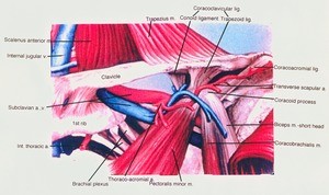 Illustration of dissection of the left axillary region, anterior view, emphasizing the major vasculature and the related structures