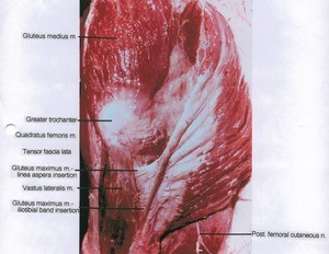 Natural color photograph of dissection of the left thigh and gluteal region, posterior view