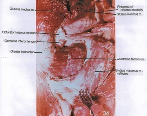 Natural color photograph of dissection of muscles of the left gluteal region, posterior view, with the gluteus maximus muscle and piriformis muscle cut and reflected