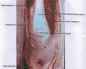 Natural color photograph of right knee, anterior view, showing muscles and bones