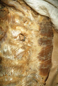 Natural color photograph of dissection of the thorax, anterolateral view, with the skin and a portion of an intercostal muscle removed to expose musculature and the left internal thoracic vein