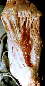 Natural color photograph of dissection of the plantar surface of the left foot