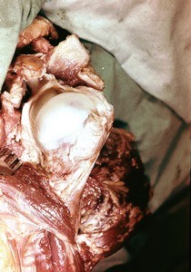 Natural color photograph of dissection of the left shoulder, lateral view, with the glenohumeral joint capsule opened and head of the humerus retracted away from the infraglenoid tubercle