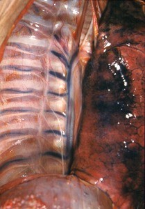 Natural color photograph of dissection of the right thorax, anterior view, with the lung removed to expose the posterior wall of the chest cavity and mediastinum