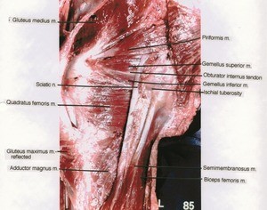 Natural color photograph of dissection of the left upper leg, posterior view, showing the exiting of the sciatic nerve below the piriformis muscle and the related structures