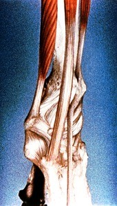 Illustration of dissected right forearm and wrist in semi-supination