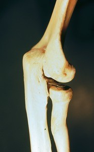 Color photograph of articulated dried bones of right elbow joint in semiflexion; lateral view