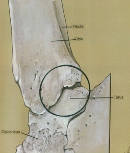 Illustration of bones of the left ankle joint, medial view