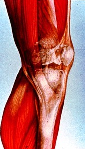 Illustration of left knee, medial view, with articular surfaces of femur, tibia & patella "ghosted in"