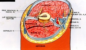 Diagrammatic illustration of cross section of right arm, superior view, showing muscles, bone, nerves, arteries and veins