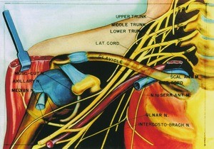 Illustration of dissection of the brachial plexus and the axillary vessels