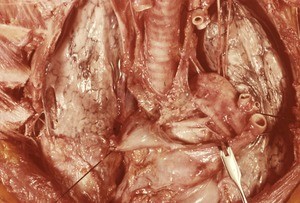 Natural color photograph of dissection of the thorax, anterior view, with the rib cage removed and the mediastinum retracted to expose the lungs and trachea