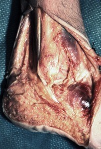 Natural color photograph of dissection of the right ankle, lateral view