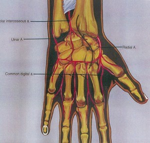 Illustration of the right hand, posterior view, showing arteries