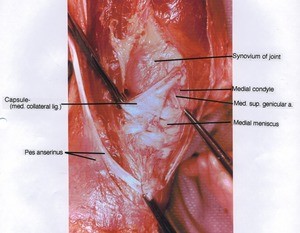 Natural color photograph of left knee, medial view, showing pes anserinus, synovium, artery, joint ligament and cartilage